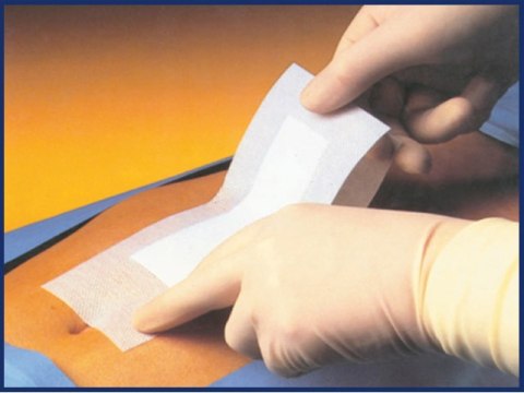 PHARMAPORE STERILE-10X20CM OPATRUNEK SAMOPRZYLEPNY JAŁOWY WŁÓKNINOWY