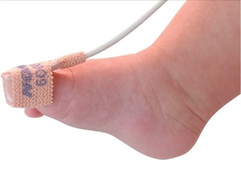 NONIN 6000C-SENSOR DO PULSOKSYMETRU NEONATOLOGICZNY JEDNORAZOWE TKANINY PULSOKSYMETRYCZNE