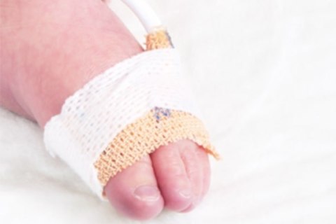 NONIN 6000C-SENSOR DO PULSOKSYMETRU NEONATOLOGICZNY JEDNORAZOWE TKANINY PULSOKSYMETRYCZNE