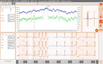 Cardioline Oprogramowanie Cubeholter do holterów Oprogramowanie Cubeholter do holterów Cardioline
